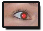 yeuxrouge